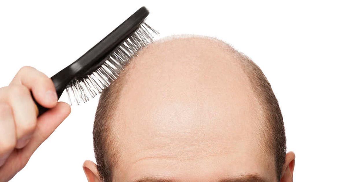 Study: being bald makes you look more masculine, intelligent and successful