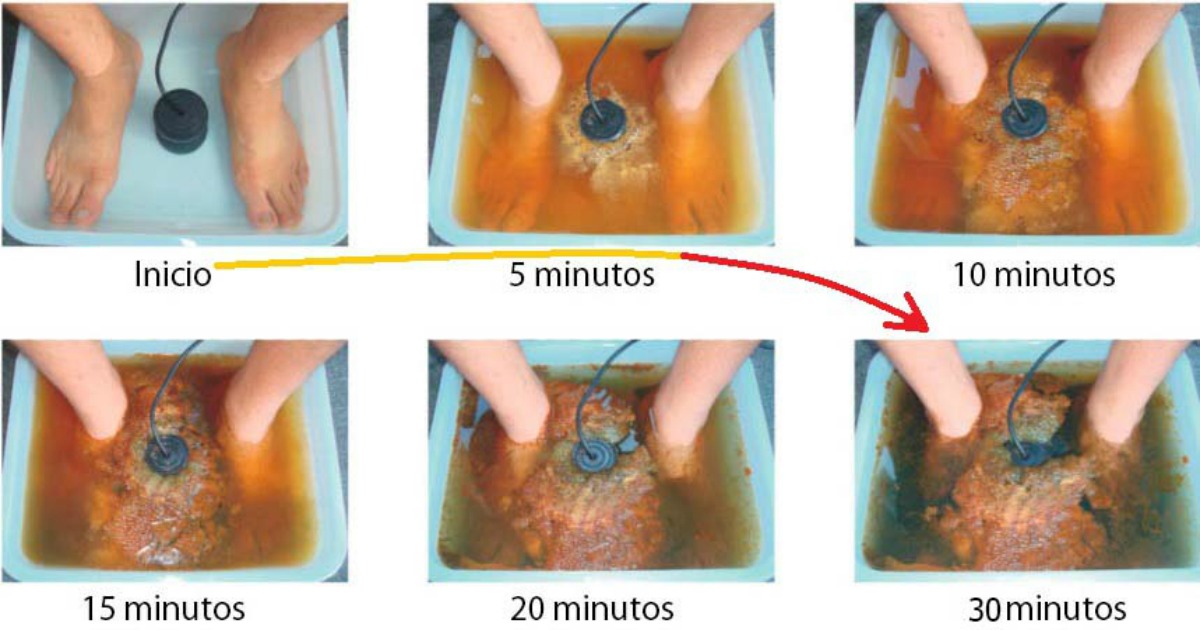 &iexcl;Si&eacute;ntete m&aacute;s sano y energ&eacute;tico desintoxicando tu organismo por medio de tus pies!