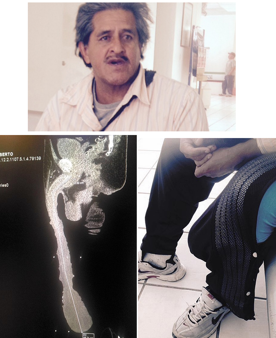 INCRE&Iacute;BLE: Mejicano pide subsidio de discapacidad debido a que su miembro es muy grande