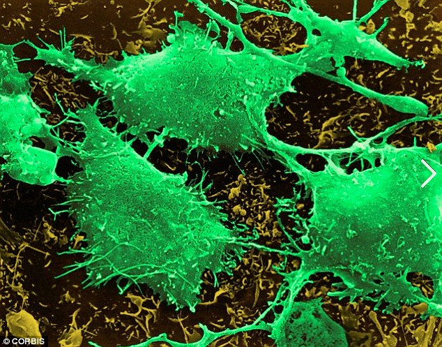 Cannabis kills cancer cells and shrinks brain tumours