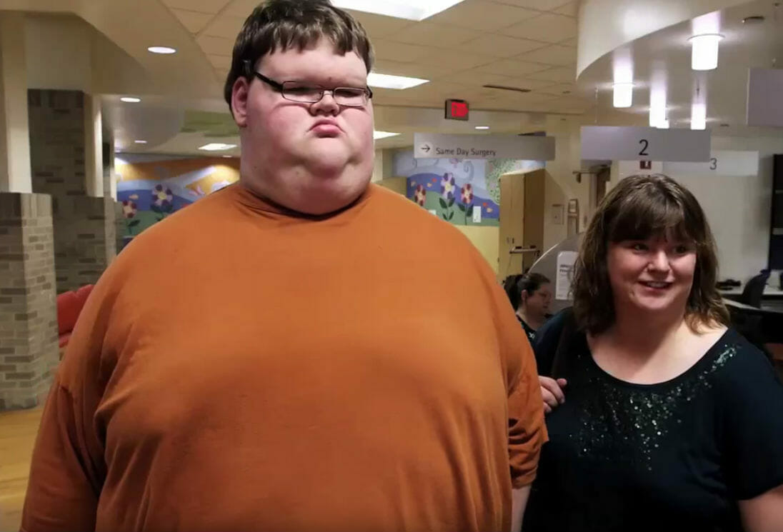 Con 325 kg era el adolescente m&aacute;s gordo del mundo, su apariencia ahora es impactante