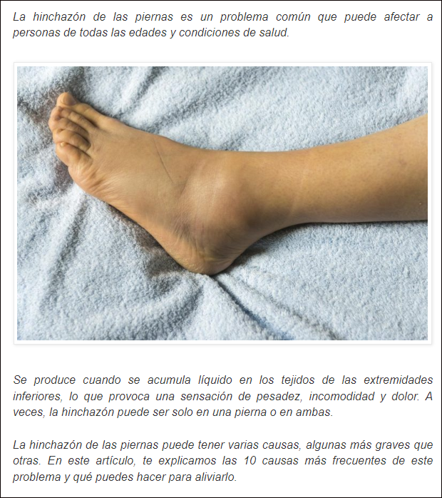 Hinchaz&oacute;n en las piernas: &iquest;Por qu&eacute; se produce?
