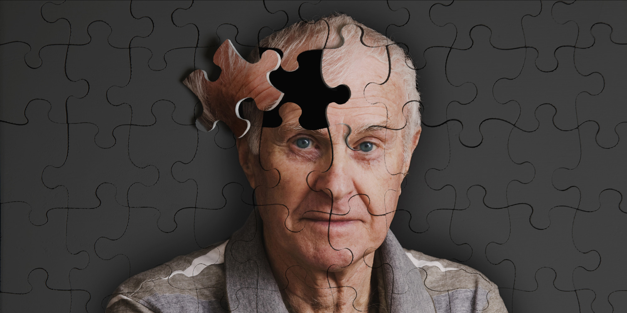 &iexcl;Importante! Descrubren c&oacute;mo se forman en el cerebro las placas del alzheimer