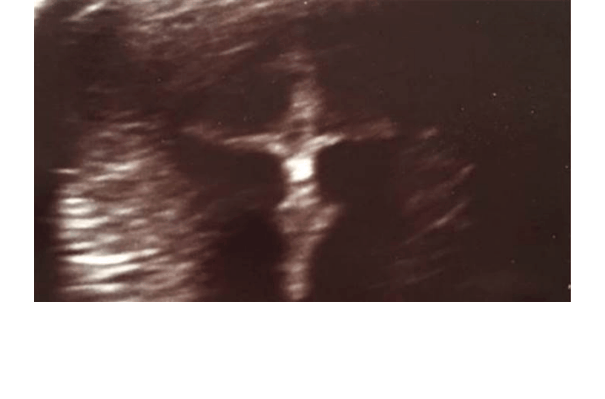 La foto de ultrasonido parece mostrar un crucifijo (traducci&oacute;n)