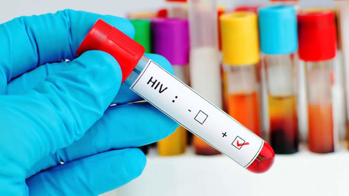 Cient&iacute;ficos logran eliminar virus del VIH en seis pacientes