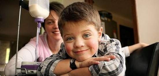La incre&iacute;ble historia del ni&ntilde;o que es al&eacute;rgico a todo tipo de alimento