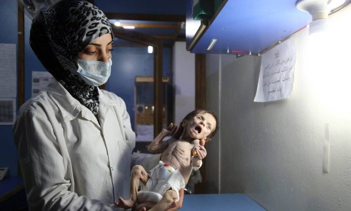 La foto de esta beb&eacute; que muri&oacute; de hambre es una demostraci&oacute;n de los horrores que viven en Siria