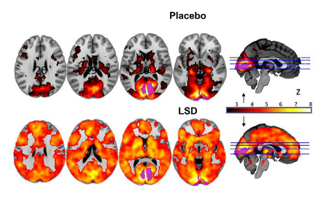  Estos son los impactantes efectos del LSD sobre tu consciencia
