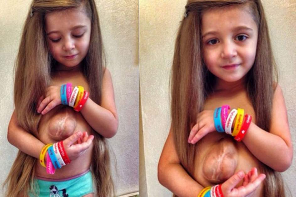 Una ni&ntilde;a sobrevive seis a&ntilde;os con el coraz&oacute;n fuera del pecho y busca ayuda por todo el mundo  Ver m&aacute;s