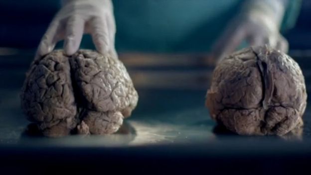 Cerebro masculino y femenino. Descubre cu&aacute;l es el tuyo