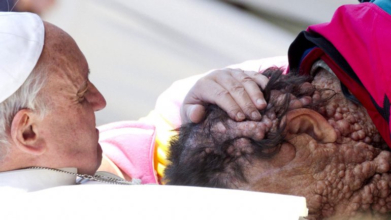 El hombre enfermo que conmovi&oacute; a Francisco