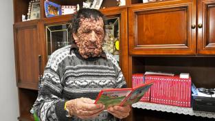 El hombre enfermo que conmovi&oacute; a Francisco