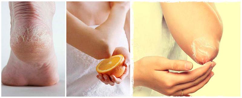 Mascarilla Casera Para Acabar Con La Resequedad Las Rodillas, Codos y Planta De Los Pies