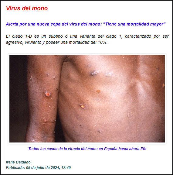  El virus del mono sigue, tambi&eacute;n, aqu&iacute;
