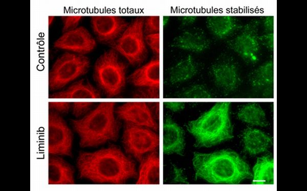 Descubren una nueva mol&eacute;cula anticancer&iacute;gena y antimet&aacute;stasis