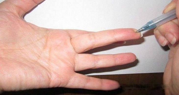Un punto particular en el dedo: Alivia de inmediato la presi&oacute;n y elimina cualquier dolor