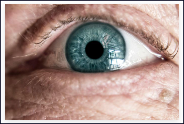  Aumenta la Degeneraci&oacute;n Macular en Espa&ntilde;a. &iquest;Como prevenir sus crueles consecuencias?