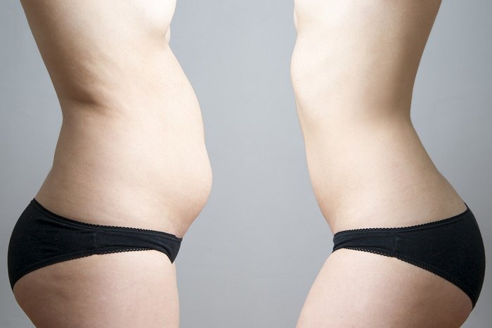 5 remedios naturales para reducir la grasa abdominal