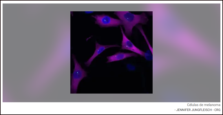  Investigaci&oacute;n: Descubierta una prote&iacute;na que puede ayudar a frenar la met&aacute;stasis