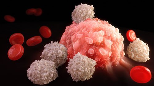 &iexcl;Attention! This type of cancer is increasing around the world