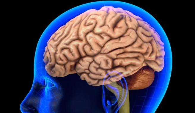 C&oacute;mo actuar ante un derrame cerebral