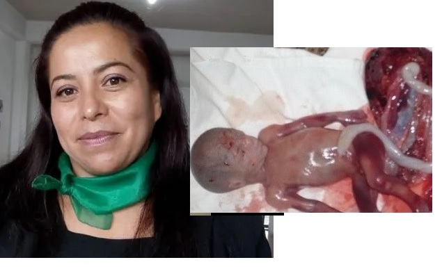 Pretenden matar ni&ntilde;os prenatales a t&eacute;rmino en Hidalgo