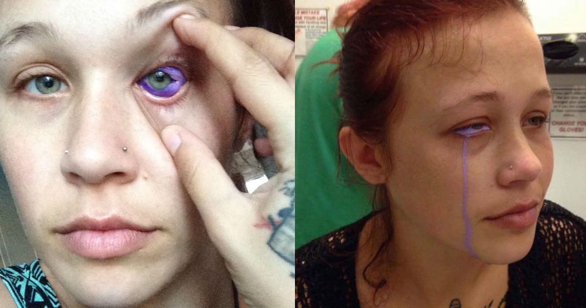 Modelo no pens&oacute; que tatuarse el ojo ser&iacute;a su peor error 