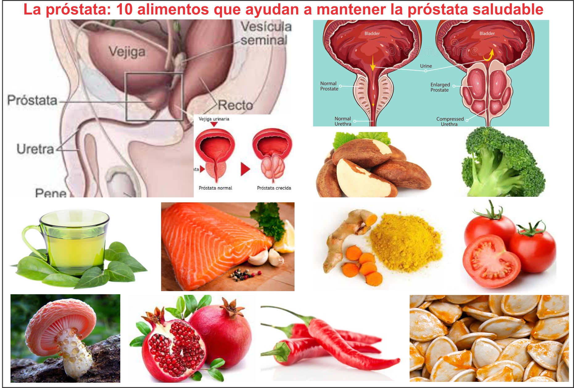  Alimentos para mantener tu pr&oacute;stata en buen estado. S&iacute;ntomas de enfermedad 