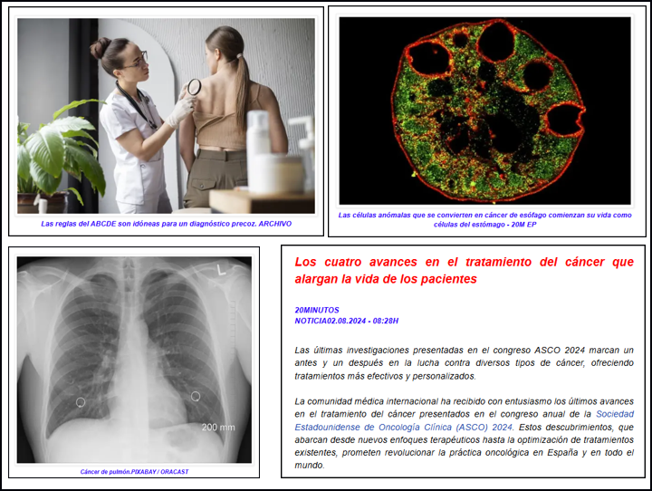 Cuatro importantes avances para el tratamiento del c&aacute;ncer