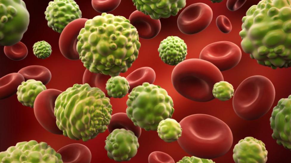 Inmunoncolog&iacute;a,una nueva v&iacute;a para curar el c&aacute;ncer