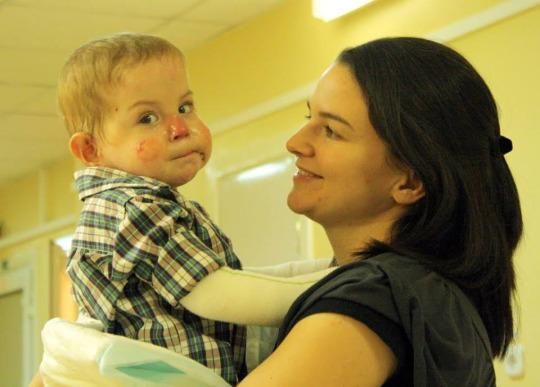 Why a Family Adopted One Twin     Left Behind by His Birth Parents