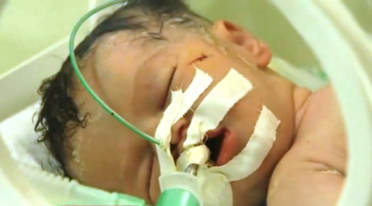 La beb&eacute; que naci&oacute; de una madre muerta en Gaza 