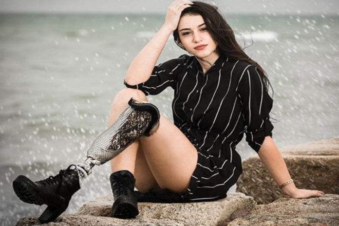 Chiara Bordi, la primera Miss Italia que desaf&iacute;a al mundo con una pierna bi&oacute;nica
