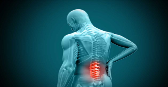 Top 9 tratamientos naturales para el dolor de ci&aacute;tica