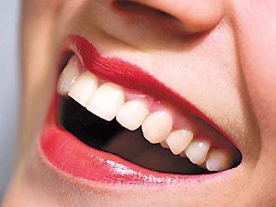 Blanqueamiento Dental Con L&aacute;ser: Una Excelente Alternativa Para La Salud Dental