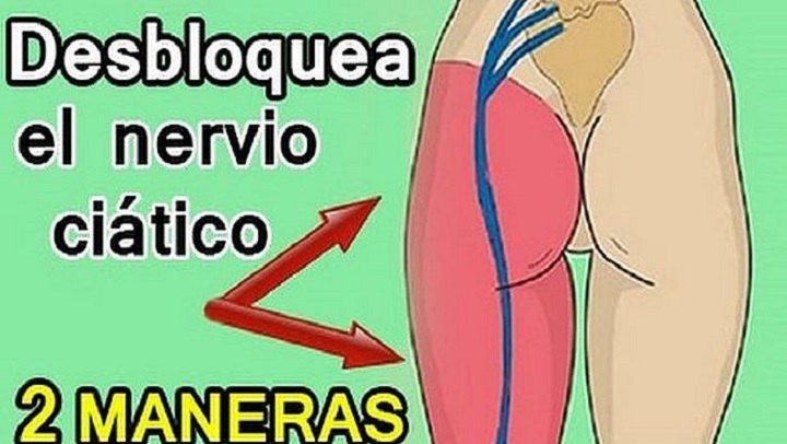C&oacute;mo desbloquear el nervio ci&aacute;tico de dos maneras