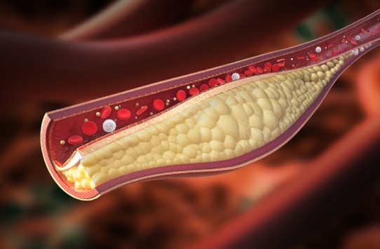 Claves para controlar los niveles de colesterol en tu cuerpo