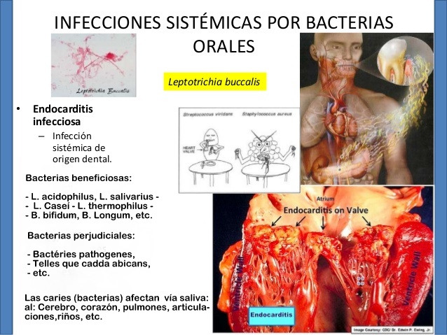 Se calcula que tenemos unas 300 especies distintas de bacteria viviendo en nuestra boca.