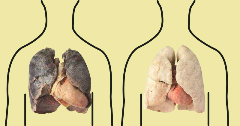  4 productos que purifican los pulmones de un fumador. &iexcl;No dejen de leerlo!
