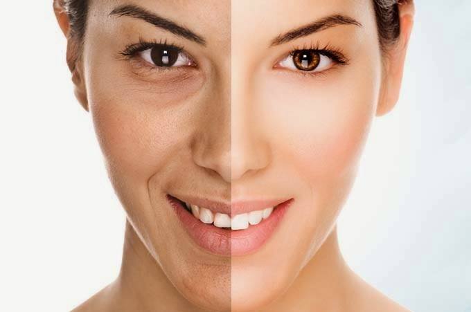 Elimina las arrugas de tu cara con este m&eacute;todo natural