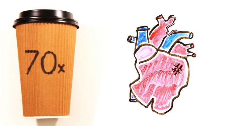 10 cosas cotidianas que (en exceso) podr&iacute;an matarte