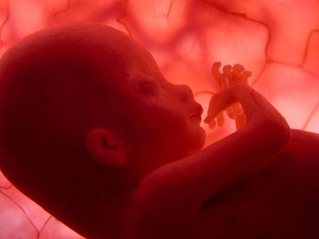 Conmovedora historia de un aborto
