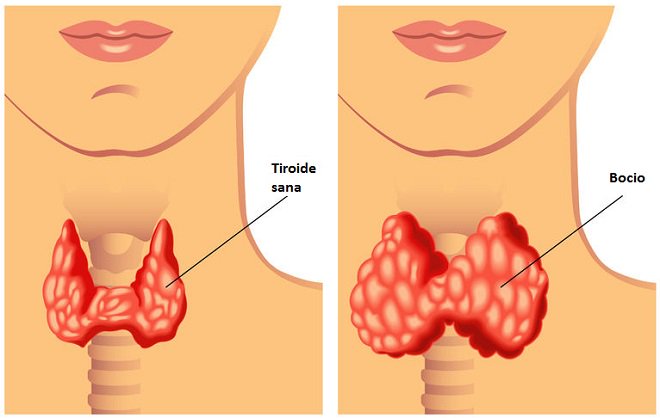 Conoce los nutrientes esenciales para que tu tiroides funcione correctamente