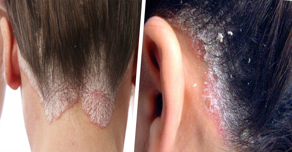 Dormir con el cabello mojado puede ser fatal, mire por qu&eacute;