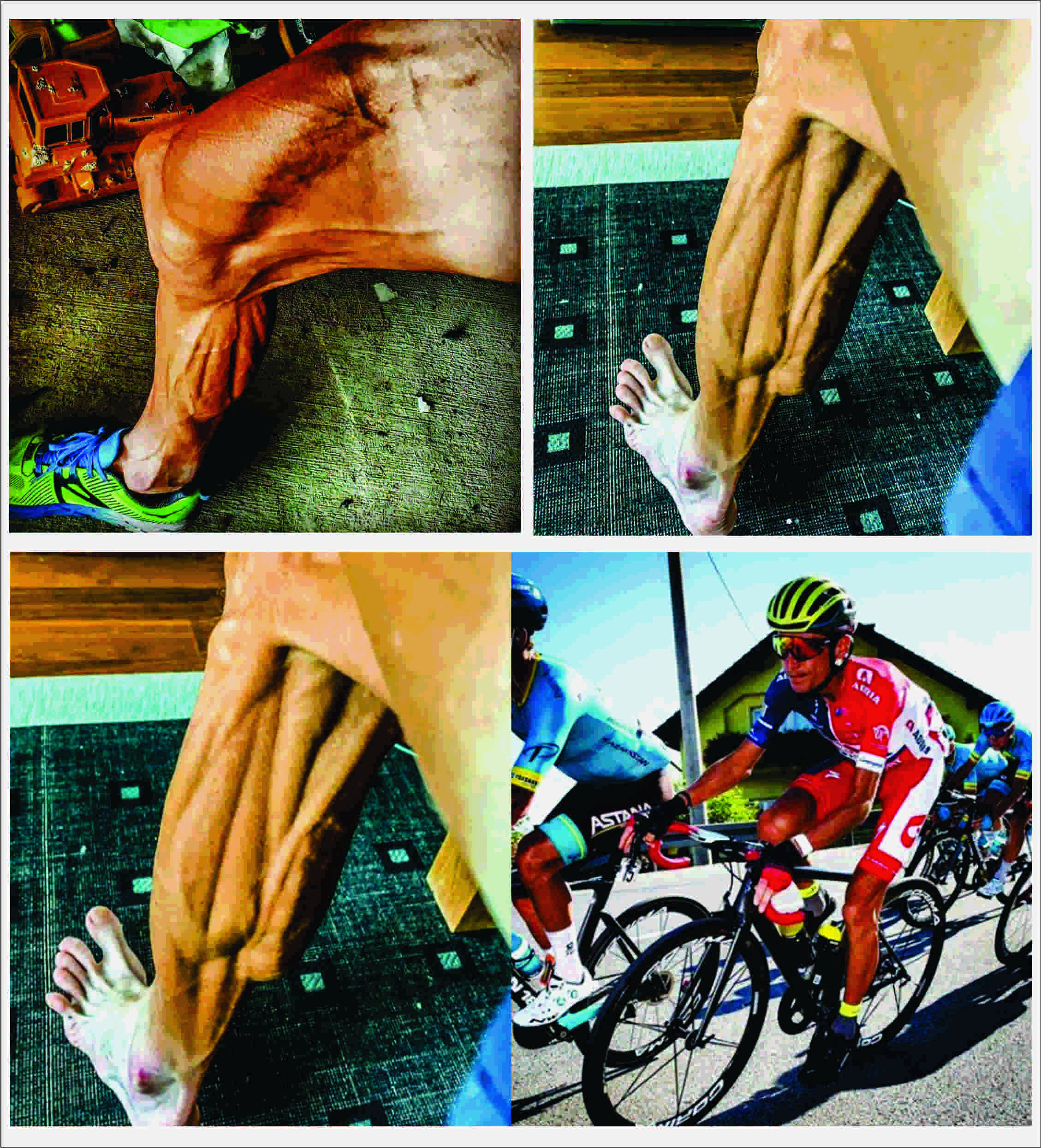 Las impresionantes im&aacute;genes de las piernas de un ciclista despu&eacute;s de competir