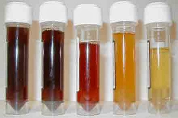SALUD: COLOR DE TU ORINA
