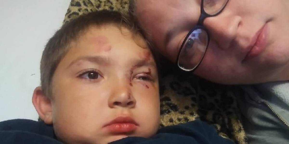 Ni&ntilde;o autista de 6 a&ntilde;os recibi&oacute; brutal golpiza por defender a su amigo del bullying