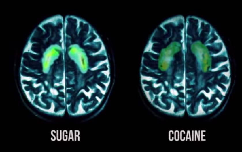 Consumir az&uacute;car provoca los mismos efectos de la coca&iacute;na, seg&uacute;n estudio