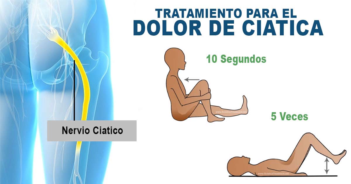 C&oacute;mo eliminar el dolor del nervio ci&aacute;tico en 60 segundos
