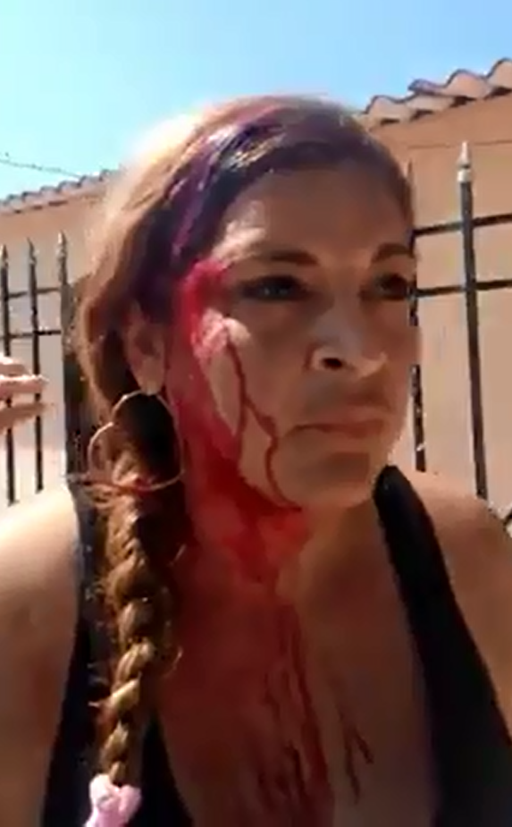 POLIC&Iacute;AS PRESUNTAMENTE LE ROMPEN LA CABEZA A UNA MUJER  VIDEO VIRAL.
